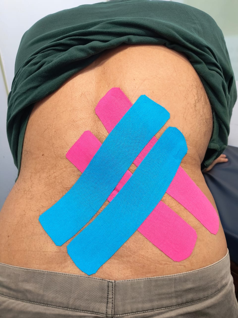 Lower back taping